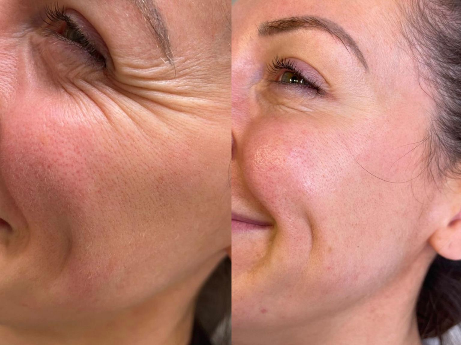 Before and after aesthetic treatment results
