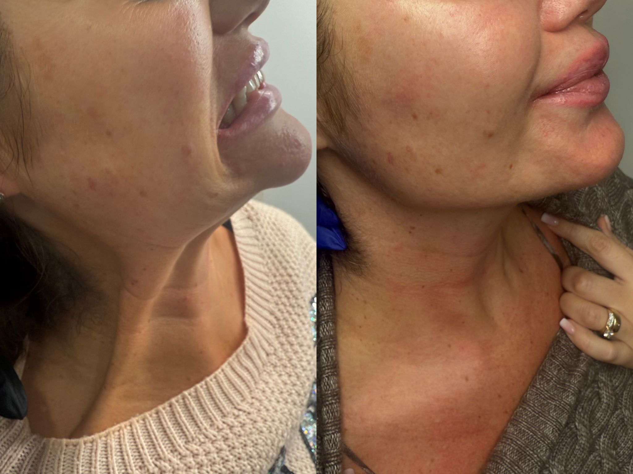 Before and after aesthetic treatment results