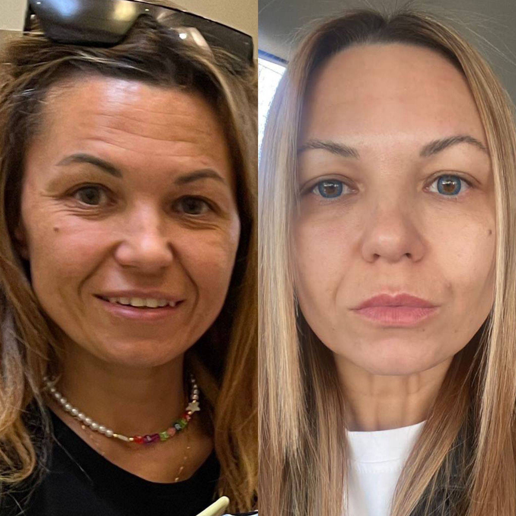 Brows and lashes treatment results