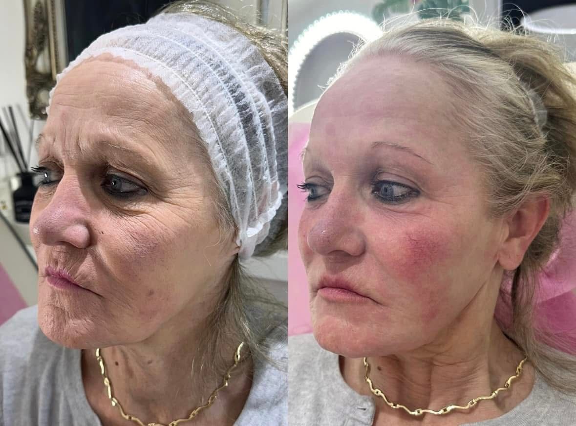 Before and after aesthetic treatment results