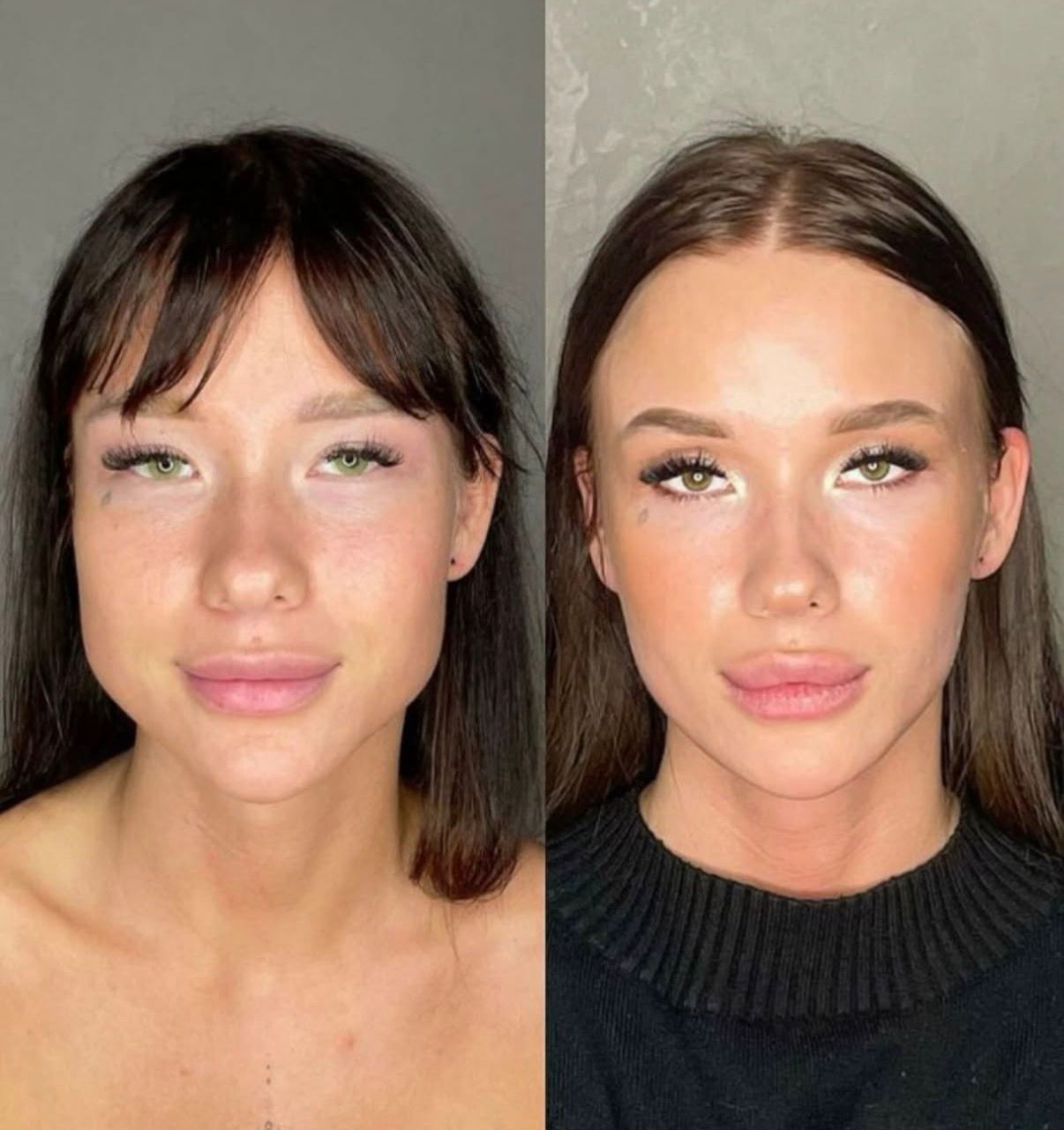 Before and after aesthetic treatment results