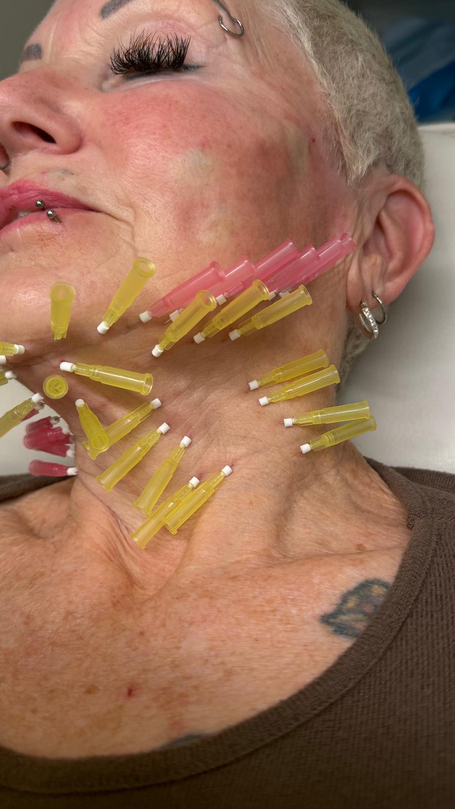 Aesthetic training course session